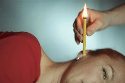 Ear candling: Safety and side effects .